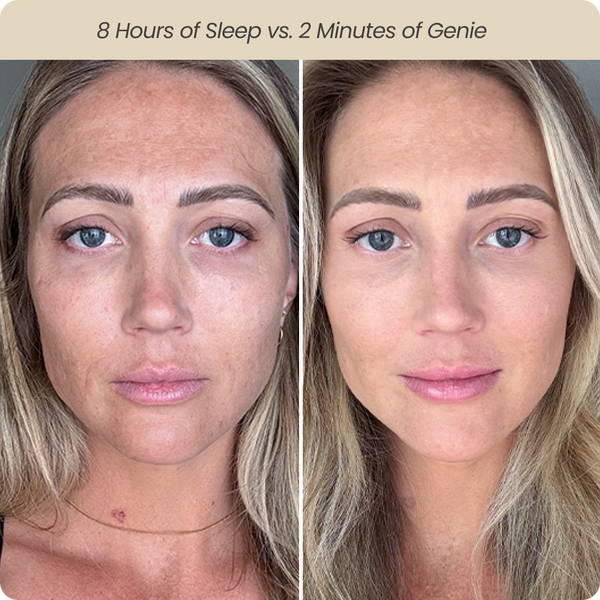 Gravity is Erasing Your Jawline Overnight