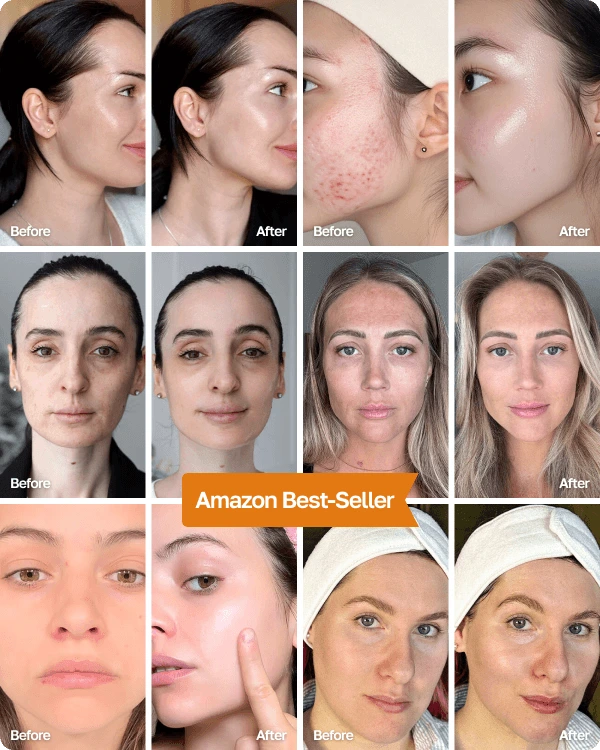 10,400+ Women Traded Expensive Facials for This Wand